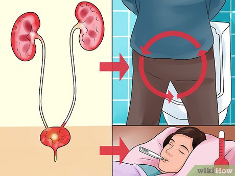 Fast Relief for Urinary Tract Infection