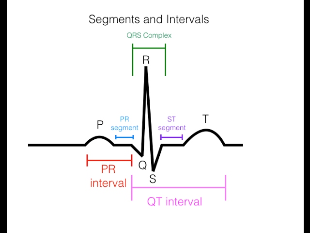 Effective Ways to Read an EKG in 2025: Understand Heart Rhythms Faster!