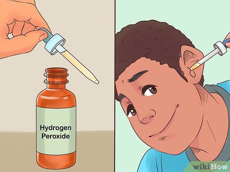 How to Effectively Remove Fluid from Ear: Tips for Quick Relief in 2025